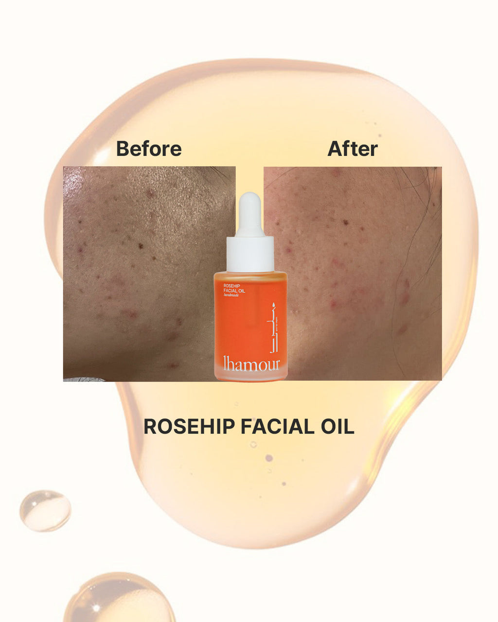 Award-Winning Natural Facial Oil For Deep Hydration & Healthy Glow